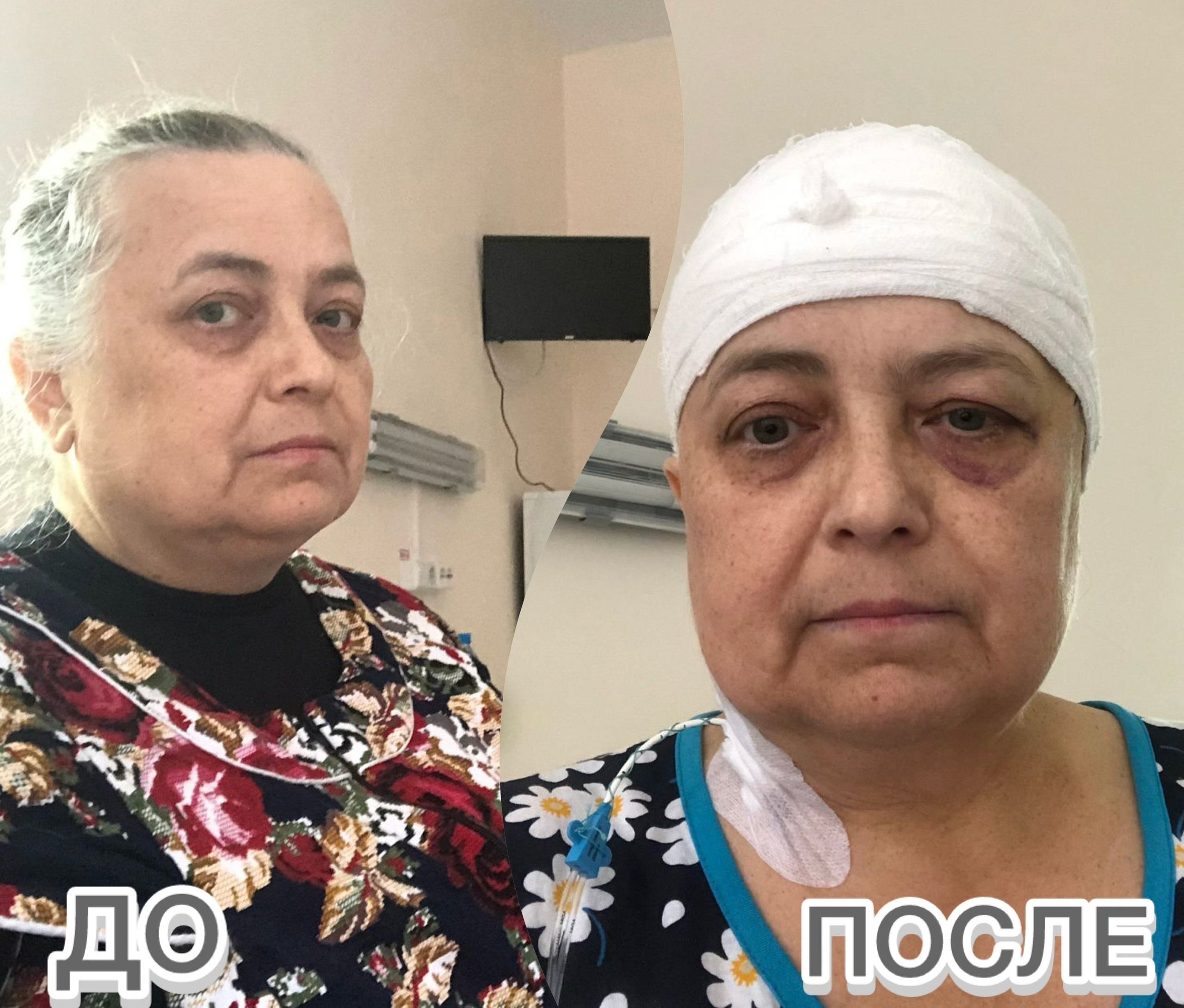 Пациентка, перенесшая операцию на мозге, поделилась своими впечатлениями от работы врачей ЯОКБ Пациентка, перенесшая операцию на мозге, поделилась своими впечатлениями от работы врачей ЯОКБ