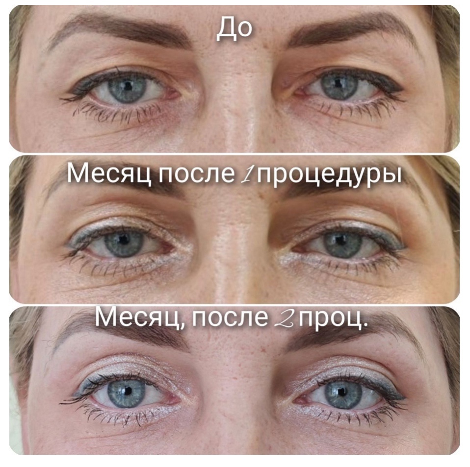 Откройте новую страницу в уходе за своей кожей с медицинской услугой «Холодная плазма»! Откройте новую страницу в уходе за своей кожей с медицинской услугой «Холодная плазма»!